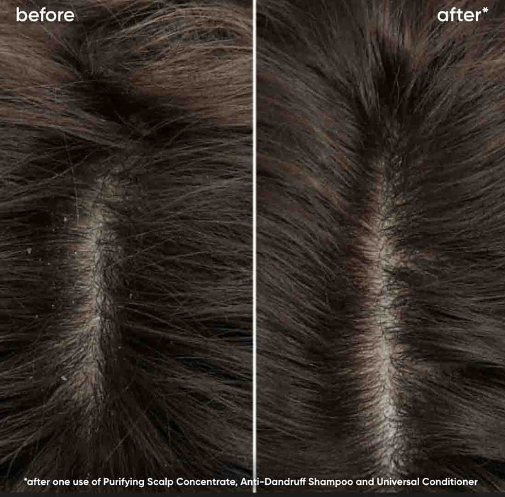 Matrix Biolage Scalp Sync Purifying Scalp Concentrate before and after from flakey and greasy to clean and refreshed